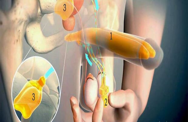 Operace lipofilu